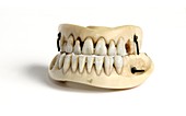 Ivory dentures with human teeth