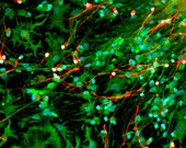 Foetal nerve cells,light micrograph