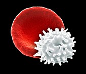Healthy and crenated red blood cells,SEM