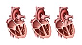 Heart valves,artwork
