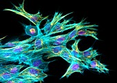 Fibroblast cells,fluorescent micrograph