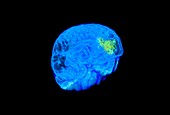 Child's brain activity,MRI scan