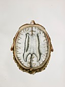 Brain and corpus callosum,1844 artwork