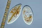 Frontonia protozoa,light micrograph