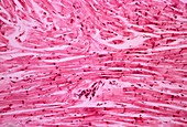 Cardiac muscle,light micrograph