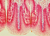 Tongue taste buds,light micrograph