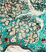 Salivary gland tissue,light micrograph
