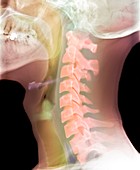 Normal neck,X-ray