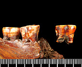 Piltdown Man jaw fragments