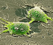 Dividing cancer cell,SEM