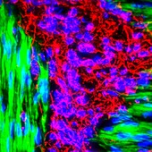 Gut vessels,fluorescence micrograph