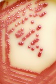 E. coli bacteria in a petri dish
