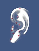Ear acupuncture,artwork