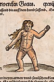 1557 Human gynandromorph transgender