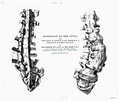 1852 Gideon Mantell fused Spine composite
