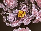 TB bacteria infecting macrophages,SEM