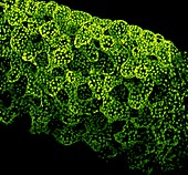 Chloroplasts,confocal micrograph