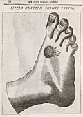 Christ's stigmata,17th century