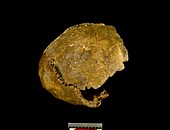 Neanderthal cranium