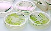 Microalgae food supplement production