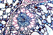 Acorus calamus rhizome,light micrograph