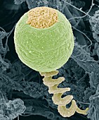 Vorticella protozoan,SEM