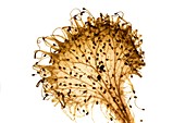 Common sundew,light micrograph