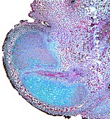 Lupin root nodules,light micrograph