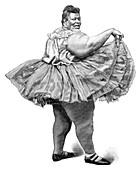Obese woman,19th century