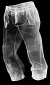 Trousers,X-ray