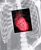 Heart,conceptual X-ray montage