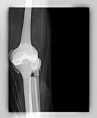 Human knee simulation,X-ray