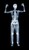 Boxing pose,X-ray