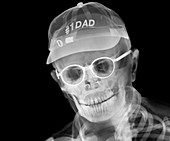 Father wearing a baseball cap,X-ray