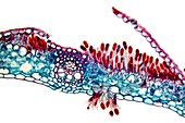 Rust fungus in a leaf,light micrograph