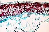 Downy mildew infection,light micrograph