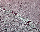 Purkinje neurons,light micrograph
