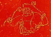 Giant chromosome,light micrograph