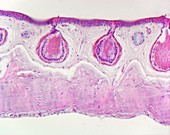 Frog skin glands,light micrograph