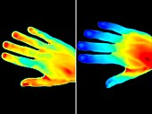 Effects of smoking,thermogram
