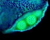 Mirabilis anther,light micrograph