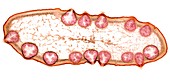 Male bladder wrack,light micrograph