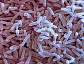 Cholera bacteria,SEM