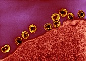 Cell infected with HIV,TEM