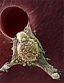 Migrating cancer cell,SEM