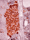 Coxsackie B3 virus particles,TEM