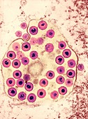 Herpes virus particles,TEM