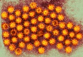 Norovirus particles,TEM