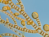 Brown alga,light micrograph
