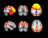 MEG and fMRI Brain Scans